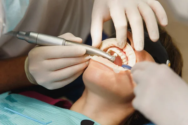 Närbild av processen att förbereda och installera keramiska tandkrona. Manliga professionella tandläkare hjälper till att behandla tänderna av kvinnlig patient på klinik ljus kontor med moderna verktyg utrustning. Öppen mun. — Stockfoto