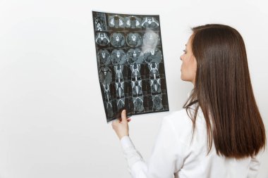 Doktor kadın yakından x-ray radyografik görüntü ct tarama MRG beyaz arka plan üzerinde izole tutar. Kadın doktor stetoskop tıbbi elbisesi. Sağlık personeli, Radyoloji tıp kavramı. Arkadan Görünüm.