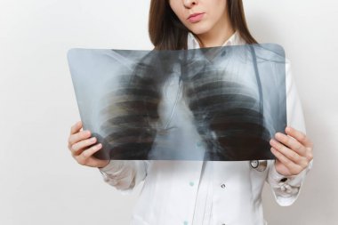 Close up cropped doctor woman with X-ray of lungs, fluorography, roentgen isolated on white background. Female doctor in medical gown stethoscope. Healthcare personnel, medicine concept. Pneumonia. clipart