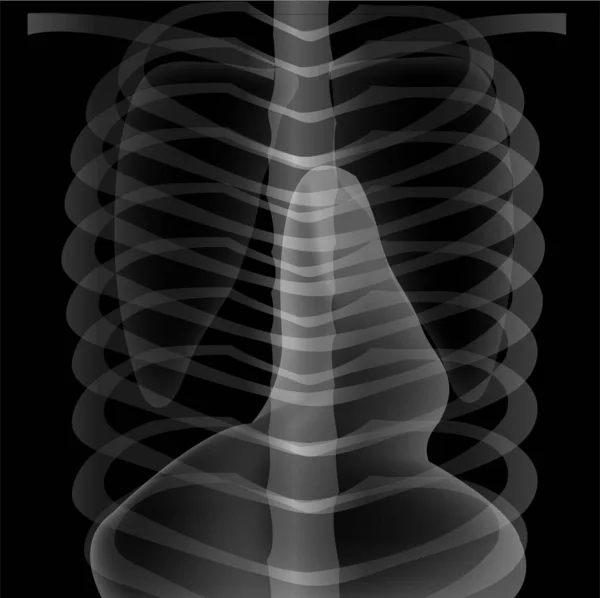 Röntgenbild Des Menschlichen Körpers — Stockvektor
