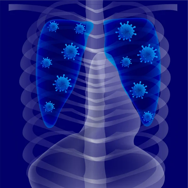 Radiografía Pulmonar Fondo Del Cuerpo Humano — Vector de stock