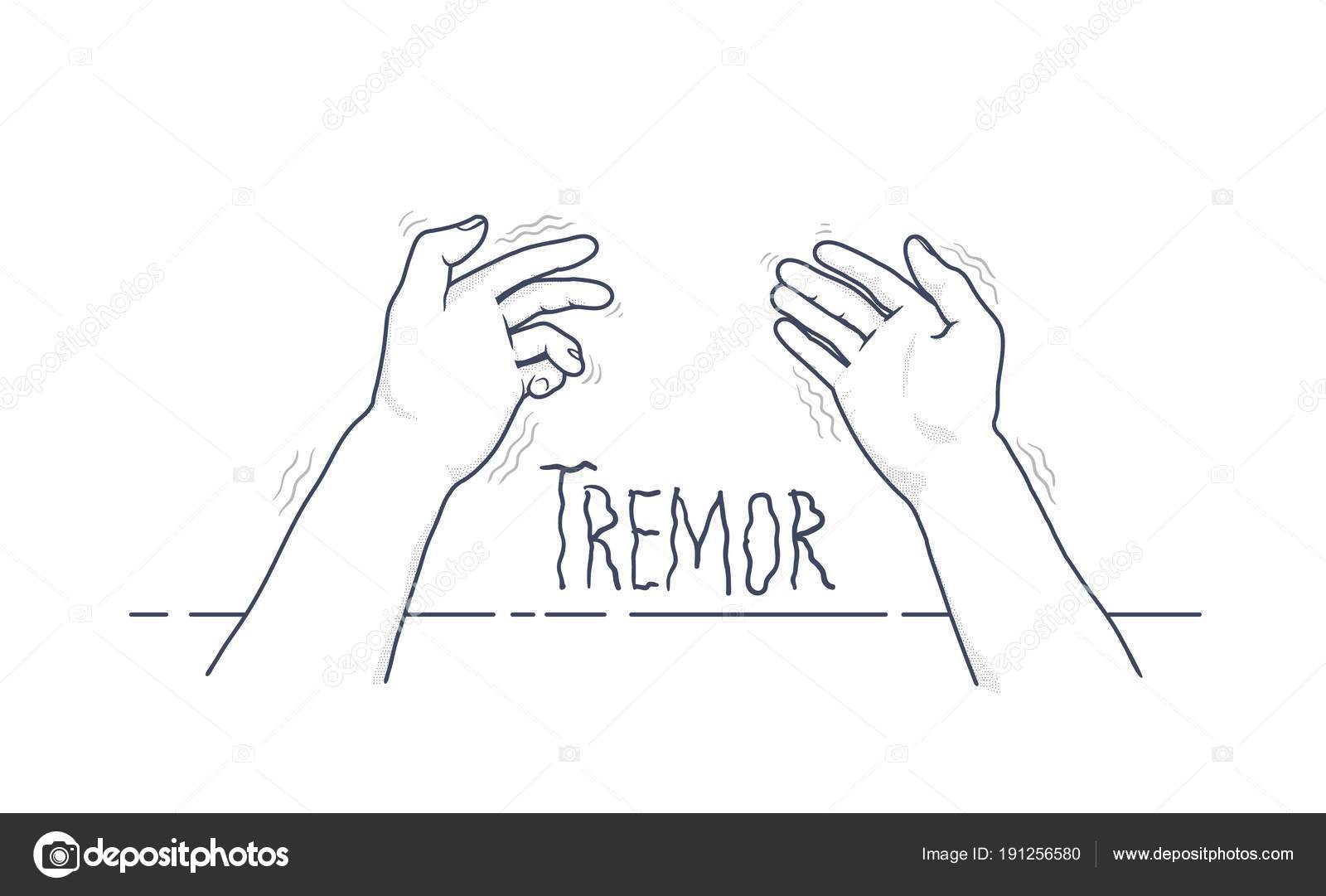 Tremor hands. Firstperson view of shaking hands. Symptom of Parkinsons