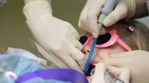 Little girl in dentist's chair having her tooth treated — Stock Video