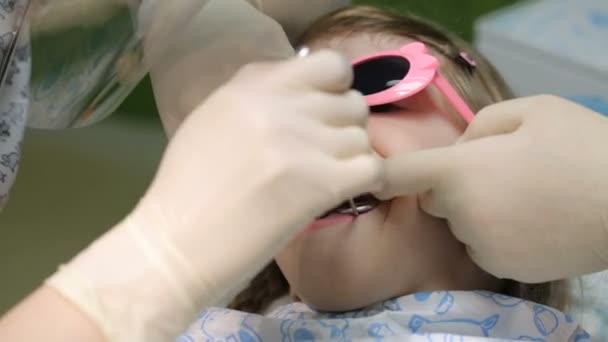 Niña en la silla del dentista teniendo su diente tratado — Vídeo de stock