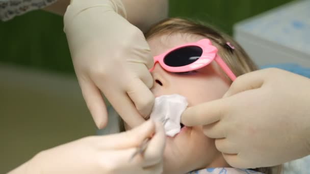 Niña en la silla del dentista teniendo su diente tratado — Vídeos de Stock