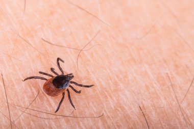 İnsan derisi üzerinde geyik kene detayını. Ixodes ricinus