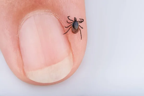 İnsan parmak ucu üzerinde kene detayını. Ixodes ricinus