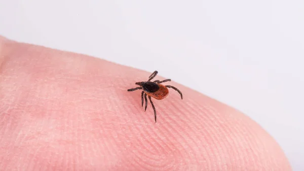 Detail skočec obecný klíštěte na kůži lidského prstu. Ixodes ricinus — Stock fotografie