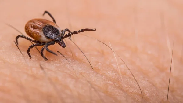 Ползучий олень клещ на волосатом фоне кожи человека. Ixodes ricinus или scapularis — стоковое фото