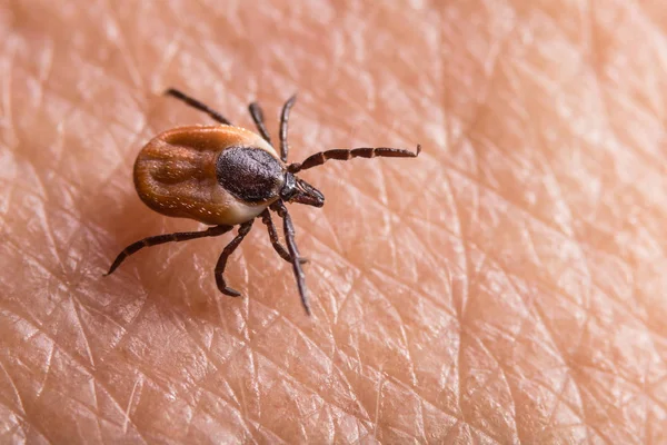 Betina castor kacang centang merangkak pada kulit manusia merah muda. Ixodes ricinus — Stok Foto