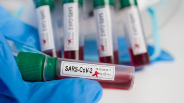 Test tüpünde SARS-CoV-2 örneği yok. COVID-19 'daki laboratuvar ekipmanları hala yaşıyor. Laboratuvar şişelerinde tıbbi kan örnekleri ve koruyucu eldiven, yüz maskesi ve kalkanın bulanık detayları. Seçici odak.