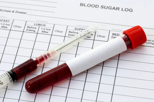 Syringe and plastic test tube with blood in laboratory — Stock Photo, Image