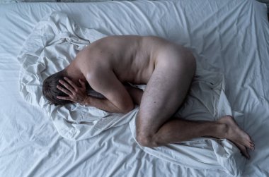 Çıplak bir adam yatakta tek başına ağlıyor üzgün ve yıkılmış hissediyor yüzünü ve cinsel organını kaplayan acı ve depresyon çekiyor. Erkeklerde cinsel yolla bulaşan hastalıklar ve testis kanseri kavramında.