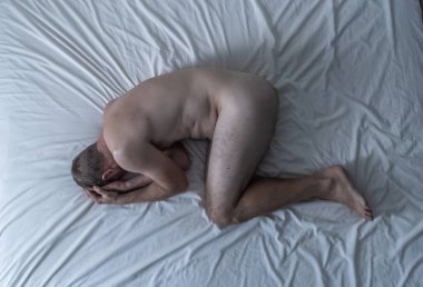 Çıplak bir adam yatakta tek başına ağlıyor üzgün ve yıkılmış hissediyor yüzünü ve cinsel organını kaplayan acı ve depresyon çekiyor. Erkeklerde cinsel yolla bulaşan hastalıklar ve testis kanseri kavramında.