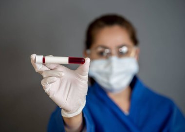 COVID-19. PPE 'deki doktor ya da laboratuvar teknisyeni. Kişisel koruyucu ekipman. Hastanedeki hastadan alınan kan örneği tüpünü tutuyor. Antikor ve aşı araştırmaları için Coronavirus kan testi.