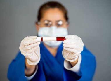 COVID-19. PPE 'deki doktor ya da laboratuvar teknisyeni. Kişisel koruyucu ekipman. Hastanedeki hastadan alınan kan örneği tüpünü tutuyor. Antikor ve aşı araştırmaları için Coronavirus kan testi.