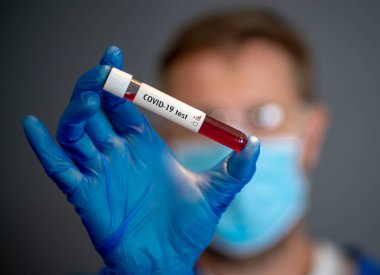 COVID-19. Kişisel Koruyucu Ekipman 'daki doktor bilim adamı laboratuvar hastanesinde enfeksiyon kapmış bir hastanın kan örneklerini tutuyor. Tıbbi tedavi ve aşı araştırmaları için Coronavirus kan testi.