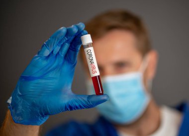 COVID-19. Kişisel Koruyucu Ekipman 'daki doktor bilim adamı laboratuvar hastanesinde enfeksiyon kapmış bir hastanın kan örneklerini tutuyor. Tıbbi tedavi ve aşı araştırmaları için Coronavirus kan testi.