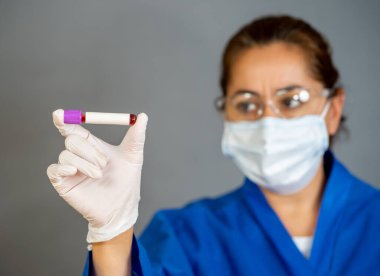 COVID-19. PPE 'deki doktor ya da laboratuvar teknisyeni. Kişisel koruyucu ekipman. Hastanedeki hastadan alınan kan örneği tüpünü tutuyor. Antikor ve aşı araştırmaları için Coronavirus kan testi.