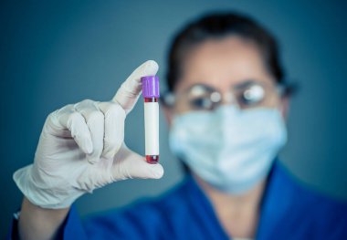 COVID-19. PPE 'deki doktor ya da laboratuvar teknisyeni. Kişisel koruyucu ekipman. Hastanedeki hastadan alınan kan örneği tüpünü tutuyor. Antikor ve aşı araştırmaları için Coronavirus kan testi.