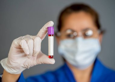 COVID-19. PPE 'deki doktor ya da laboratuvar teknisyeni. Kişisel koruyucu ekipman. Hastanedeki hastadan alınan kan örneği tüpünü tutuyor. Antikor ve aşı araştırmaları için Coronavirus kan testi.