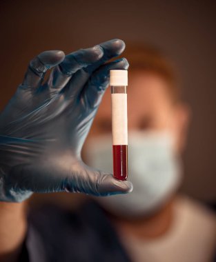 COVID-19. PPE 'deki doktor ya da laboratuvar teknisyeni. Kişisel koruyucu ekipman. Hastanedeki hastadan alınan kan örneği tüpünü tutuyor. Antikor ve aşı araştırmaları için Coronavirus kan testi.