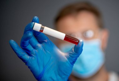 COVID-19. PPE 'deki doktor ya da laboratuvar teknisyeni. Kişisel koruyucu ekipman. Hastanedeki hastadan alınan kan örneği tüpünü tutuyor. Antikor ve aşı araştırmaları için Coronavirus kan testi.