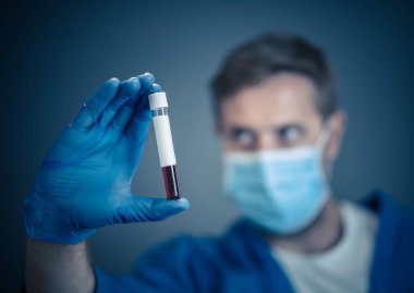 COVID-19. PPE 'deki doktor ya da laboratuvar teknisyeni. Kişisel koruyucu ekipman. Hastanedeki hastadan alınan kan örneği tüpünü tutuyor. Antikor ve aşı araştırmaları için Coronavirus kan testi.