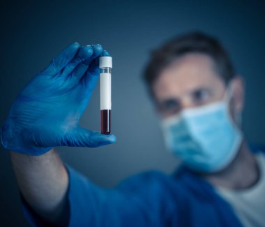 COVID-19. PPE 'deki doktor ya da laboratuvar teknisyeni. Kişisel koruyucu ekipman. Hastanedeki hastadan alınan kan örneği tüpünü tutuyor. Antikor ve aşı araştırmaları için Coronavirus kan testi.