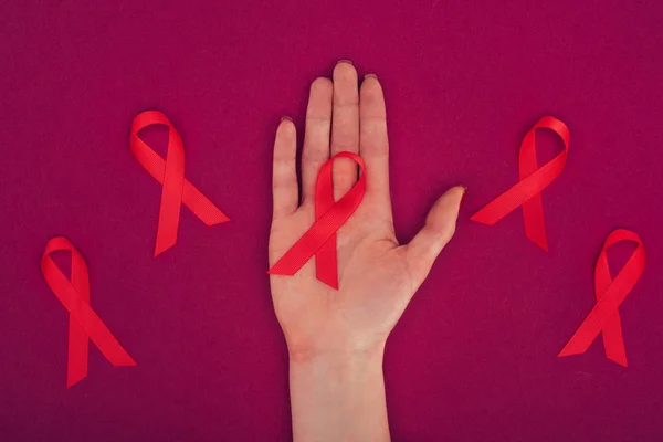 AIDS şeritler ile el — Stok fotoğraf