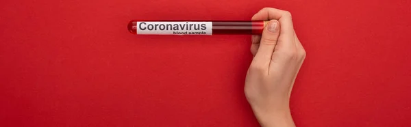 Draufsicht Der Frau Reagenzglas Mit Blutprobe Und Coronavirus Schriftzug Auf — Stockfoto