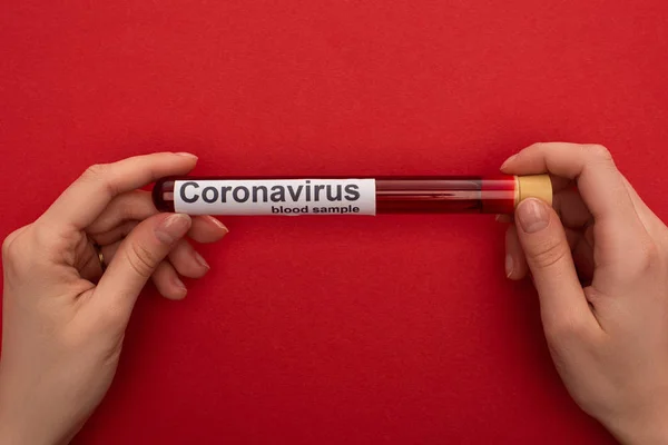 Top View Woman Holding Test Tube Blood Sample Coronavirus Lettering — Stockfoto