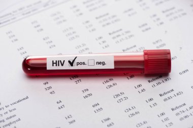 positive hiv blood sample test on paper result form clipart