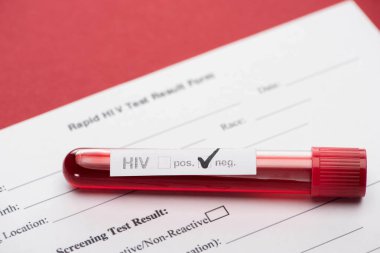Kırmızı zemin üzerinde negatif HIV kan örneği olan hızlı HIV test formu