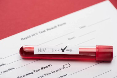 rapid HIV test result form with negative hiv blood sample test on red background clipart