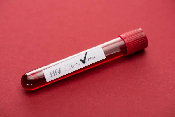 Prueba Negativa Muestra Sangre Hiv Sobre Fondo Rojo — Foto de Stock