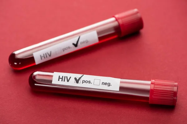 Enfoque selectivo de la prueba de muestra de sangre de hiv negativa y positiva sobre fondo rojo - foto de stock