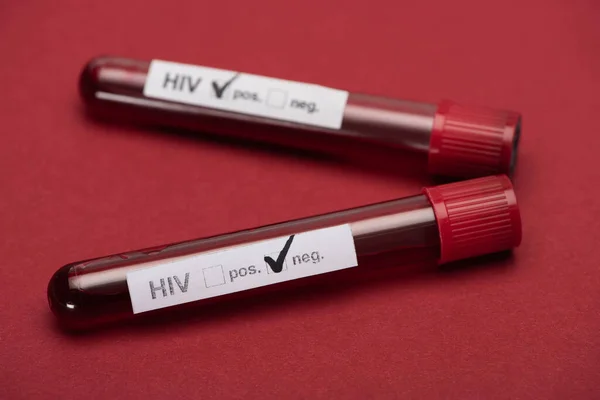 Enfoque selectivo de la prueba de muestra de sangre de hiv negativa y positiva sobre fondo rojo - foto de stock