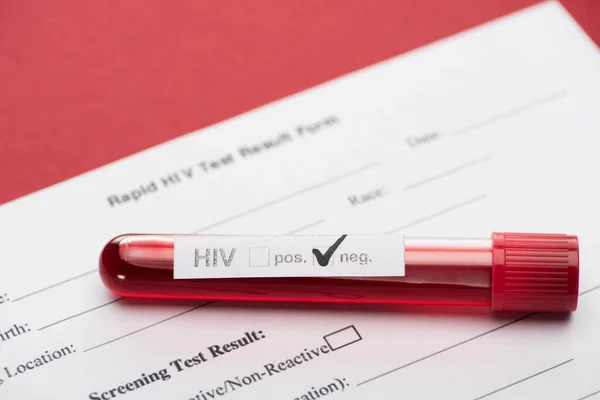 Formulário rápido do teste do HIV com teste negativo da amostra de sangue do hiv no fundo vermelho — Fotografia de Stock