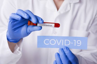 Laboratuvardaki Corona Virüsü. Kan Testi yapan bir bilim adamı. Yeni Salgın Coronavirüs 2019 nCoV