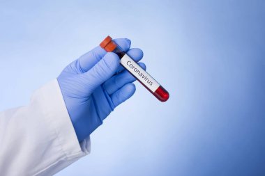 Coronavirus 2019-ncov kan örneği. Corona virüsü salgını. Salgın Virüsü Solunum Sendromu