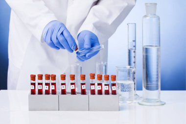 Coronavirus 2019-ncov kan örneği. Corona virüsü salgını. Salgın Virüsü Solunum Sendromu