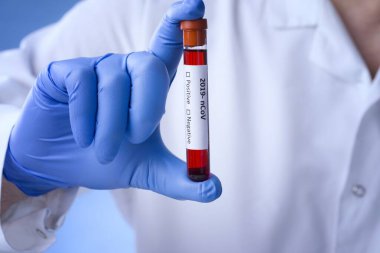 Coronavirus 2019-ncov kan örneği. Corona virüsü salgını. Salgın Virüsü Solunum Sendromu