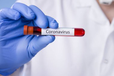 Coronavirus blood test result, blood infected with coronavirus in vacuum test tube in doctors hands with text Coronavirus in laboratory. Diagnosis, detection, analysis of Chinese coronavirus. Epidemic clipart