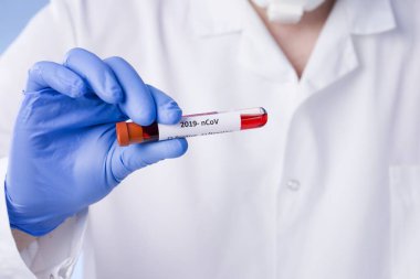 Coronavirus kan testi sonucu vakum test tüpündeki koronavirüs enfeksiyonu laboratuvarda Coronavirus metniyle doktorların ellerinde. Tanı, tespit, Çin koronavirüsü analizi. Salgın