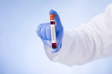 Coronavirus kan testi sonucu vakum test tüpündeki koronavirüs enfeksiyonu laboratuardaki Coronavirus metniyle doktorların ellerinde..