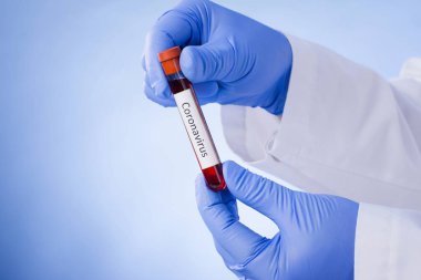 Coronavirus kan testi sonucu vakum test tüpündeki koronavirüs enfeksiyonu laboratuardaki Coronavirus metniyle doktorların ellerinde..