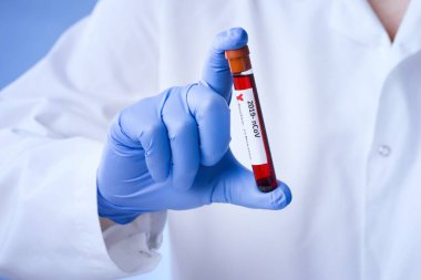 Coronavirus blood test result, blood infected with coronavirus in vacuum test tube in doctors hands with text Coronavirus in laboratory. clipart