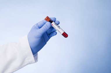 Coronavirus kan testi sonucu vakum test tüpündeki koronavirüs enfeksiyonu laboratuardaki Coronavirus metniyle doktorların ellerinde..