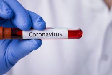 Coronavirus kan testi sonucu vakum test tüpündeki koronavirüs enfeksiyonu laboratuardaki Coronavirus metniyle doktorların ellerinde..